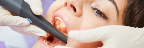 A dentist using an intraoral scanner to examine a patient's teeth.