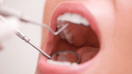 Close-up of a dental check-up showing dental tools inside an open mouth.