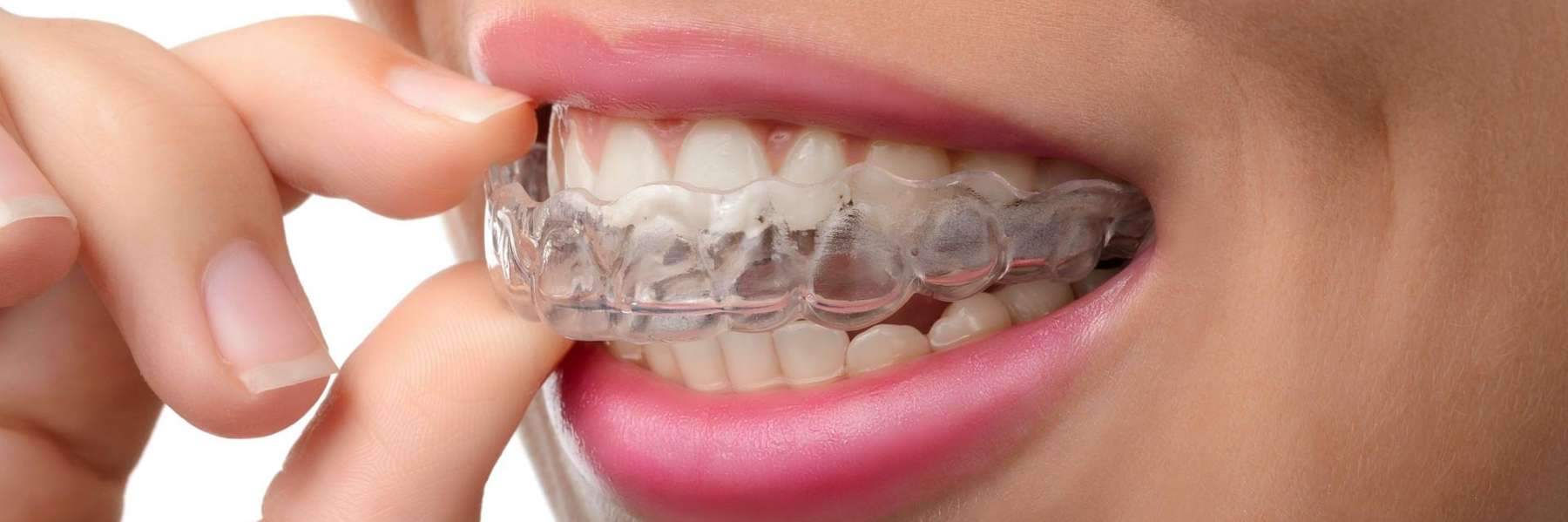 woman uses oral appliance for sleep apnea treatment in royal palm beach
