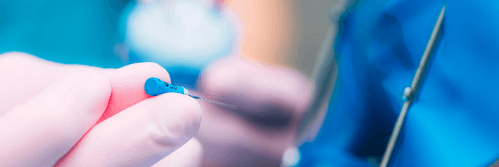 A gloved hand holds an endodontic file used for root canal treatment.